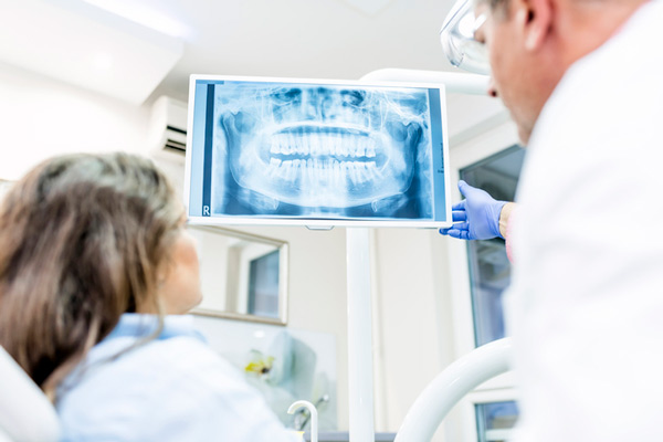 Dentist explaining digital x-ray to a woman in dental chair