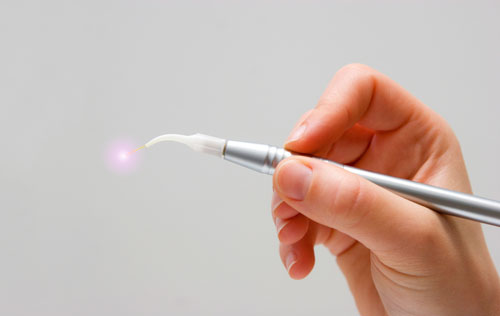 Close up of hand holding dental laser